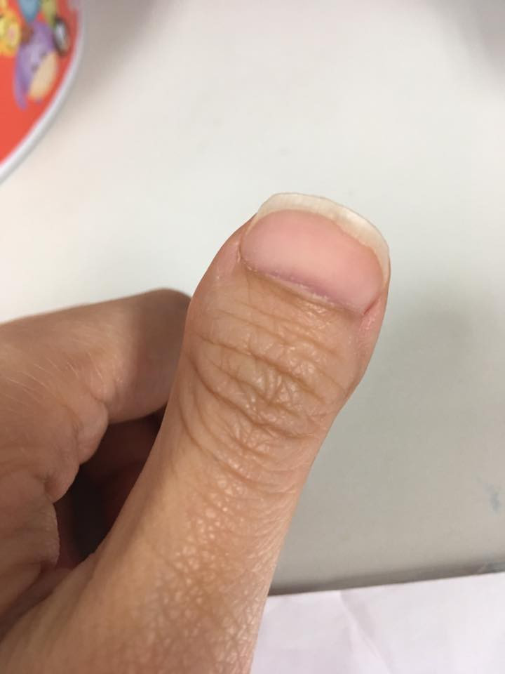 Nói thật chứ ngón tay ngắn có gì mà xấu, trông lạ lạ, yêu yêu.