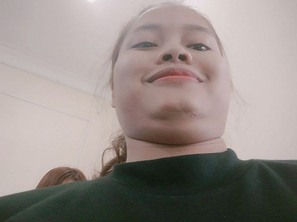 "Em chỉ muốn một cằm thôi, cớ sao lại cứ hai cằm thế này cơ chứ".