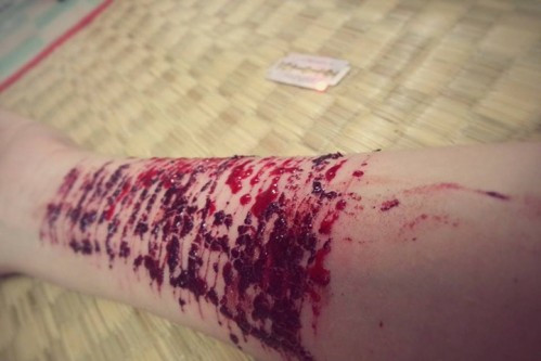 Trào lưu rạch tay từng lan rộng trên mạng xã hội khiến nhiều bậc phụ huynh phải đau đầu ngăn chặn.