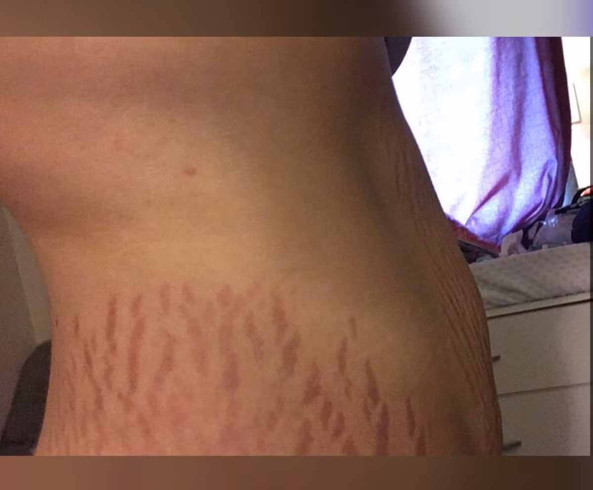 Theo nickname Mariane Bisshop chia sẻ: "Christine là một người dũng cảm, cô ấy đã truyền cảm hứng để những người phụ nữ sau khi mang thai hoặc giảm cân không còn tự ti về những vết rạn xấu xí trên cơ thể mình. Đây là sự sáng tạo và đẹp mắt".