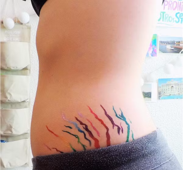 Vì quá béo nên Christine đã phải phẫu thuật cắt vạt dạ dày để giúp giảm cân. Sau đó cô tiếp tục phẫu thuật cắt bỏ lớp mỡ và da thừa ở bụng để tạo ra vùng bụng phẳng và săn chắc hơn. Tuy nhiên, phần da bị rạn da vì quá béo làm cô nàng này phải suy nghĩ và đã nảy ra ý nghĩ biến chúng thành một bức tranh đầy màu sắc.