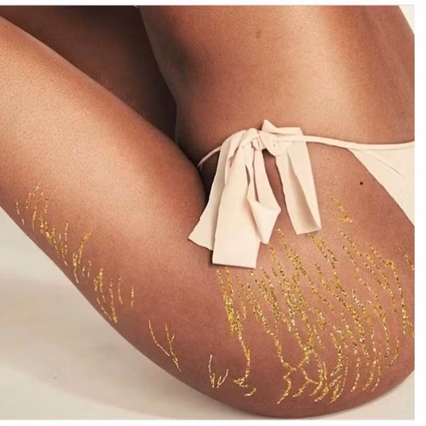 Những vết nhũ được chị em phụ nữ có vết rạn trên cơ thể sáng tạo trên cơ thể mình và không ngần ngại đăng tải trên mạng xã hội.