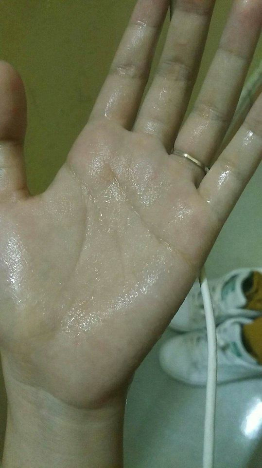 Phía dưới phần bình luận bài viết này, nhiều thành viên cũng đã đăng tải bức ảnh bàn tay ướt nhẹp của mình.