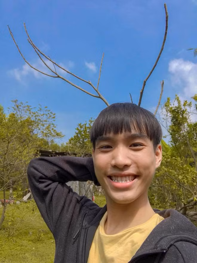 Nhiều người nhận xét rằng chưa cần anh chàng này mở miệng, chỉ cần nhìn mặt thôi là đã phải bật cười.