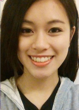 Berry Ng (22 tuổi) hiện sinh sống và làm việc tại Hong Kong. Cô bạn này bắt đầu quen với việc động "dao kéo" từ năm 17 tuổi phải nó rõ thêm rằng, Berry Ng ở thời điểm chưa chỉnh sửa sở hữu nhan sắc không tới nỗi nào nhưng để chiều lòng người yêu cô nàng này đã phẫu thuật thẩm mỹ trên khuôn mặt của mình.