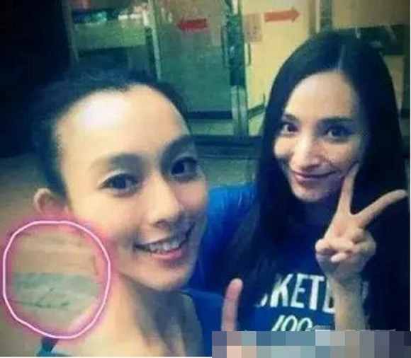 Cổ của Phạm Vĩ Kỳ biến dạng vì chỉnh sửa ảnh.