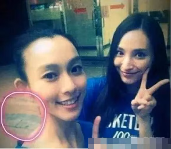 Cổ của Phạm Vĩ Kỳ biến dạng vì chỉnh sửa ảnh.