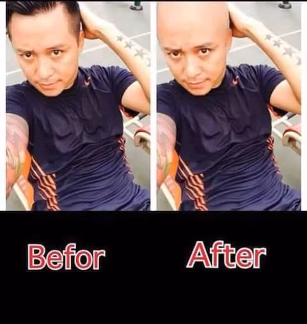 Ảnh chế trước và sau khi "xuống tóc" của ca sĩ Tuấn Hưng.