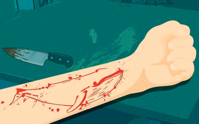 Lật lại về trò thử thách "Cá voi xanh", yêu cầu người chơi phải thực hiện hàng loạt thử thách trong vòng 50 ngày, vào lúc 4 giờ sáng mỗi ngày. Người tham gia bị điều khiển bởi quản trị viên, thực hiện các nhiệm vụ từ bình thường đến nguy hiểm, từ đơn giản đến "khó khăn" như: trao đổi thông tin trên mạng về cá voi xanh; xem phim Cá voi xanh; xem phim kinh dị; vẽ hình cá voi xanh (bằng bút bi) lên cơ thể; sử dụng dao, lưỡi lam hoặc kim khâu để tạo hình dáng con cá voi lên cánh tay hoặc chân.