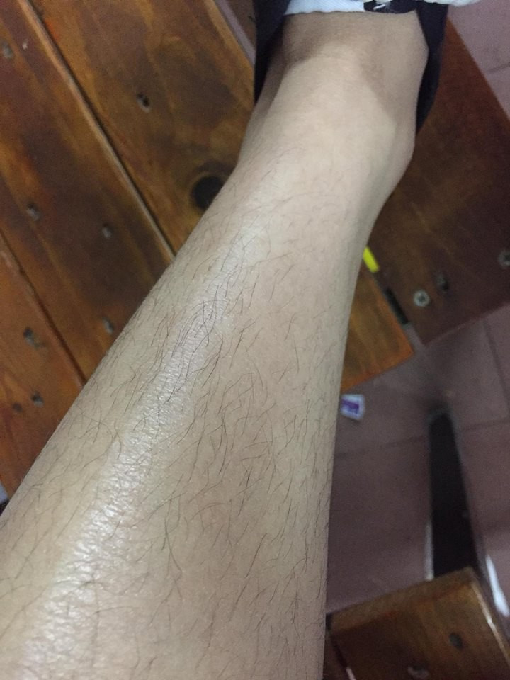 Không ít các chị em đã khoe ảnh những đôi chân nõn nà của con gái mà lông mọc còn rậm hơn con trai.