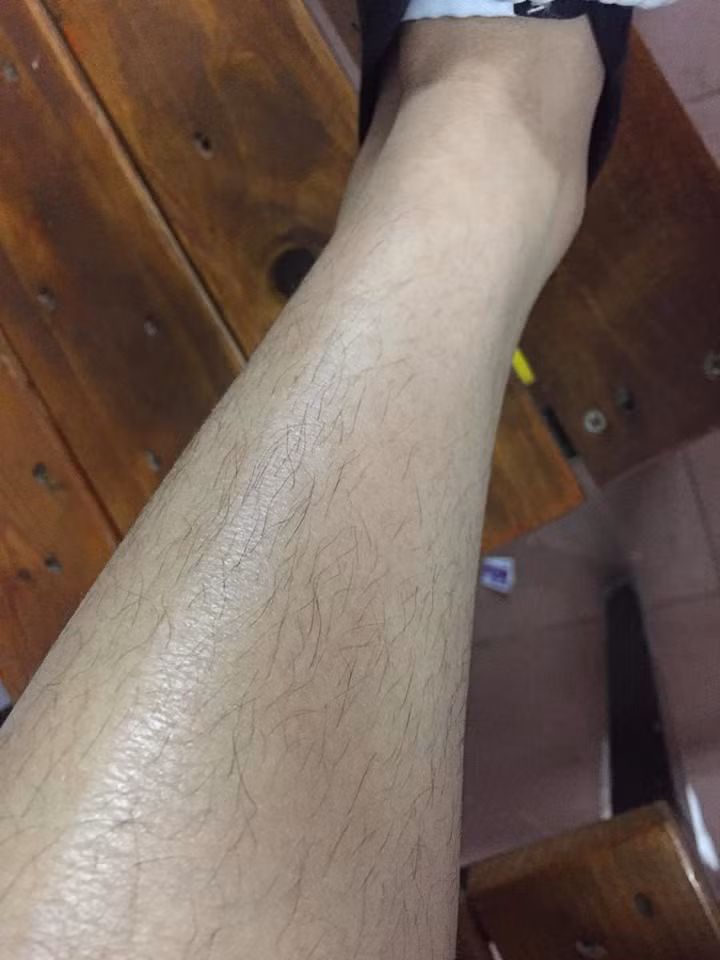 Không ít các chị em đã khoe ảnh những đôi chân nõn nà của con gái mà lông mọc còn rậm hơn con trai.