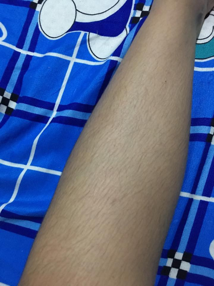 Nhìn đôi chân này liệu bạn có hiểu gì không? Đây chính là nỗi lòng của những cô nàng chân muốn được diện quần short đấy. Lười wax và wax quá đau nên chỉ wax phần chân bị lộ ra thôi