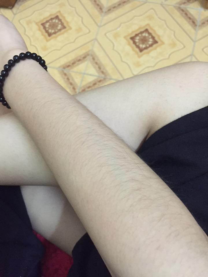 Từ xưa đến nay con trai mà lông lá một chút thì cũng có ai nói gì đâu. Nhưng con gái mà lông tay lông chân mọc vừa nhiều vừa rậm không chỉ bị trêu chọc mà còn tự ti đủ đường.