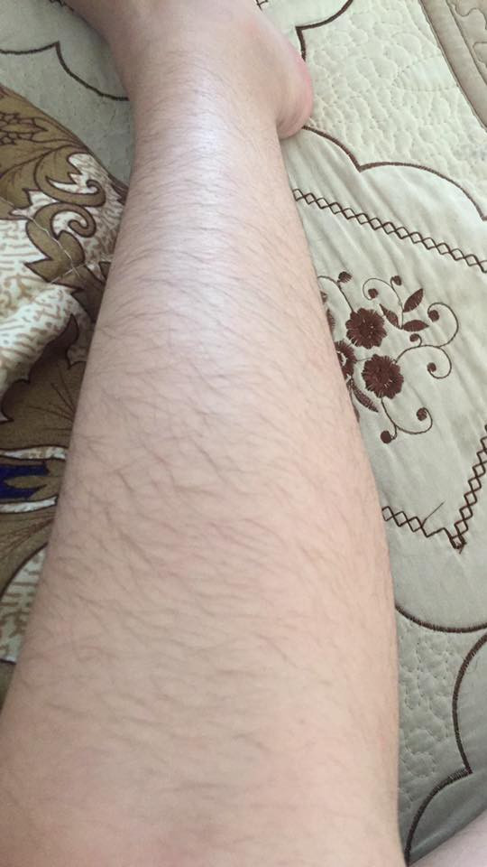 Khi đăng ảnh chân mình lên Facebook và 9/10 cái bình luận đều là: "Chân thằng nào đây?" thì bạn đau lòng biết bao...