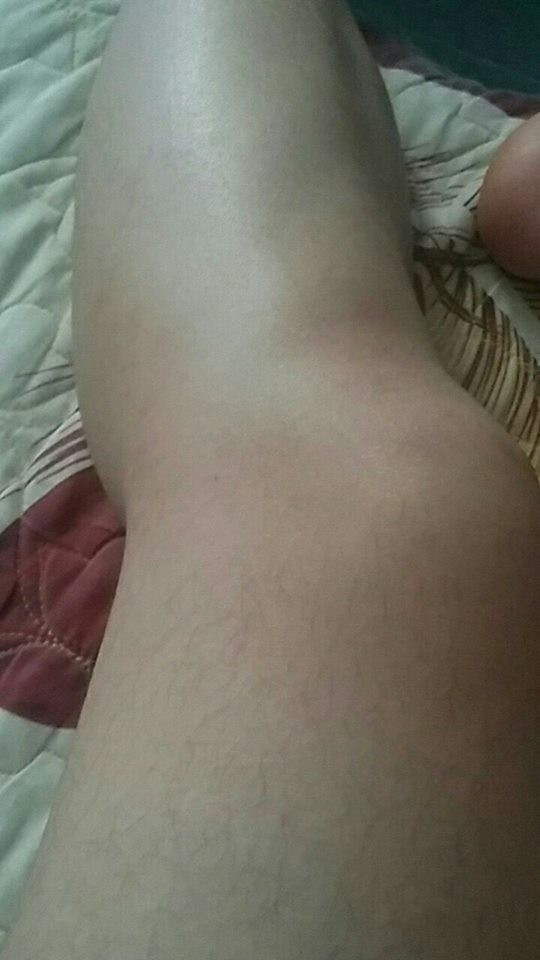 Đi kèm với những bức ảnh khoe mình thiếu may mắn là những chia sẻ của các chị em như: "Phận là con gái nhưng lông tay nhiều hơn con trai, tủi thân khủng khiếp" hay "Nhiều lúc ngồi buồn nghịch đống lông chân và tự hỏi phải chăng ông trời đã sinh nhầm giới tính cho mình?"