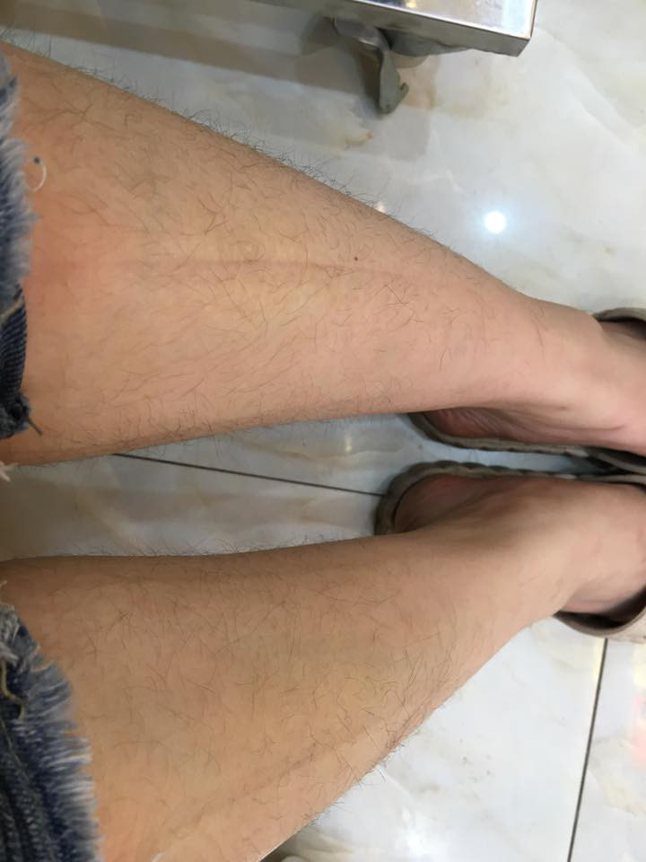 Thông qua những bức ảnh kêu khổ vì lông của các chị em, các anh em cũng góp ý kiến rằng làm đẹp là quyền của các bạn vậy hãy cứ làm tốt những gì mình có quyền.