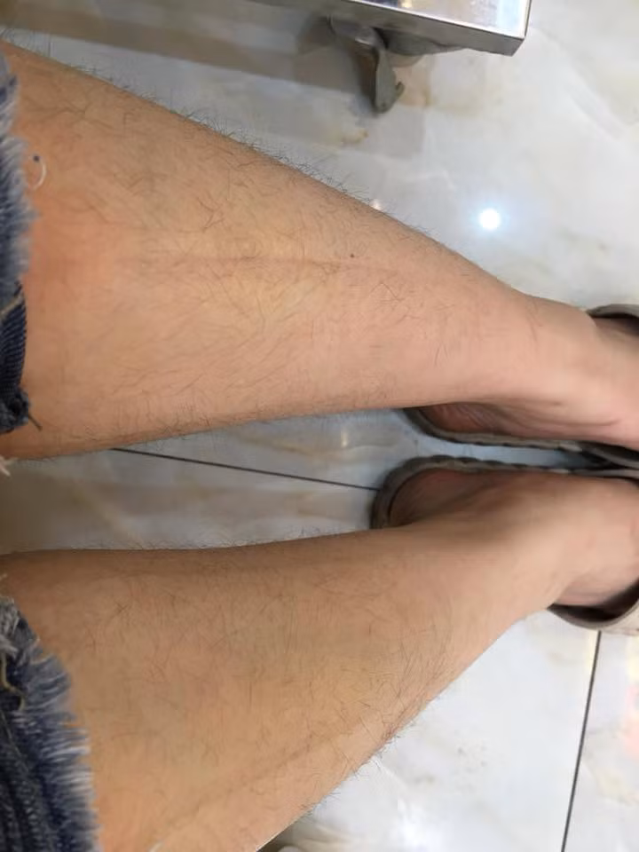 Thông qua những bức ảnh kêu khổ vì lông của các chị em, các anh em cũng góp ý kiến rằng làm đẹp là quyền của các bạn vậy hãy cứ làm tốt những gì mình có quyền.