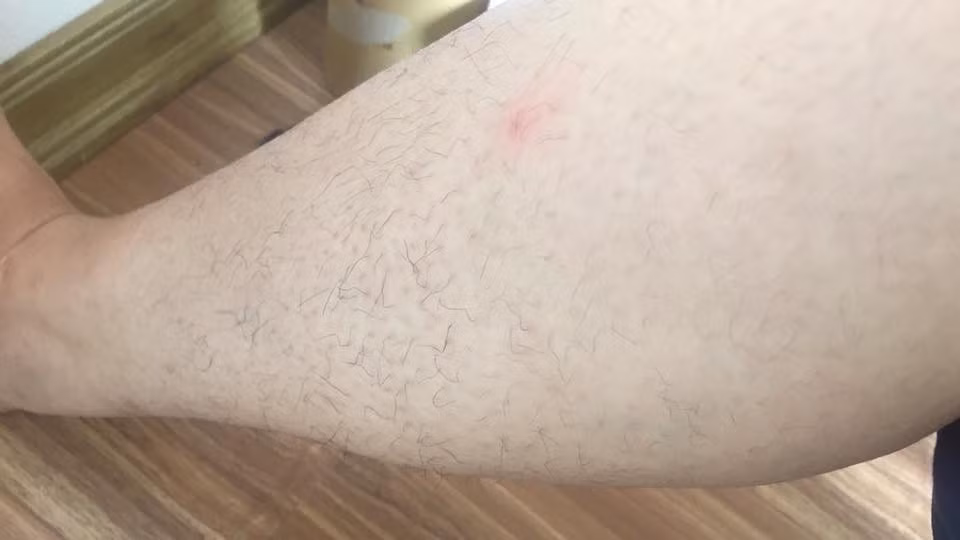 Cũng chính bởi vậy mà ngoài việc trang điểm để có một khuôn mặt đẹp trước khi ra đường, hội bạn gái cũng chú ý đến những biện pháp tẩy lông, đơn giản như cạo hay cao cấp hơn là dùng đến công nghệ triệt nang lông.