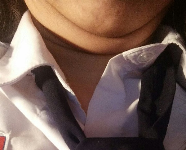 Bên cạnh đó, vẫn có những chị em không vui việc khuôn mặt hai cằm của mình. Đơn cử như bạn trẻ Minh Hoa: "Nhìn chỉ cười nhẹ một tí, sao lại ra nông nỗi cơ chứ. Em buồn lắm nhưng chẳng biết sao được?"