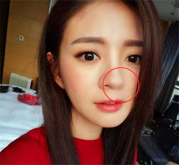 An Dĩ Hiên tự tin khoe ảnh selfie đẹp không tì vết mà không để ý rằng một bên lỗ mũi của cô đã biến mất.