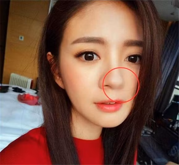 An Dĩ Hiên tự tin khoe ảnh selfie đẹp không tì vết mà không để ý rằng một bên lỗ mũi của cô đã biến mất.