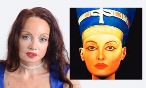 Choang vang nhung ca phau thuat tham my quai di nhat dia cau