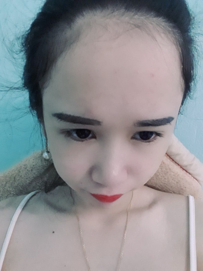 Còn nickname Bảo Oanh thì cho hay: "Người ta tự hào về điểm này điểm kia trên khuôn mặt còn mình thì khốn khổ với vầng trán siêu cao".