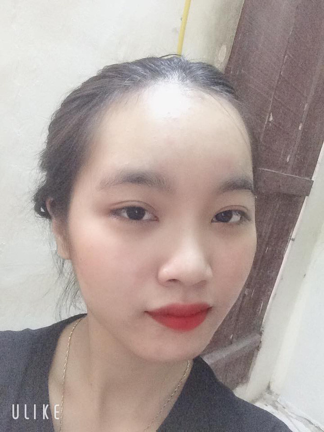 Trán lúc nào cũng đi trước người là đây chứ đâu, nhìn cái trán chiếm hết nửa khuôn mặt có buồn không cơ chứ.