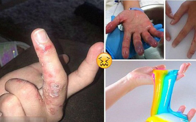 Chất nhờn ma quái Slime được nhắc đến là oại chất dẻo đặc biệt, vừa mềm vừa dẻo và rất dai…chúng có thể biển đổi thành những hình thù kỳ lạ. Chính vì thế trẻ em đặc biệt yêu thích, các em có thể tạo ra vô số hình dạng độc đáo khác nhau.