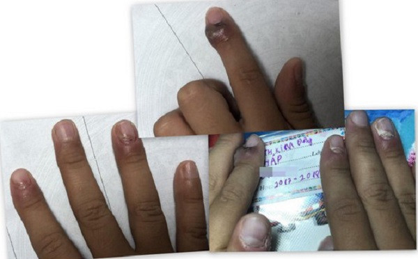 Slime được bán công khai tại các cổng trường Tiểu học, Trung học Cơ sở. Chúng được các tiểu thương nhập về hay tự chế tại nhà mà không được kiểm tra của bất cứ cơ quan an toàn chất lượng nào.