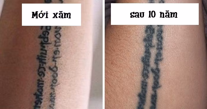 Sau khi những hình xăm phai màu theo năm tháng chúng sẽ bị nhòe đi, thậm chí nhiều người còn không nhớ rằng mình đã xăm gì.