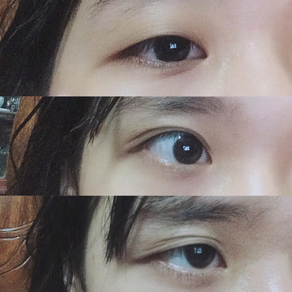 Bạn Linh Lan cùng chung 'nỗi khổ': 'Giống mình, mắt nổ mắt xịt lắm. Càng thức khuya càng lộ rõ hai mí cơ. Còn ngủ nhiều nó húp mắt lại vô một mí luôn'.