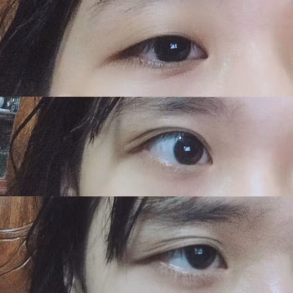 Bạn Linh Lan cùng chung 'nỗi khổ': 'Giống mình, mắt nổ mắt xịt lắm. Càng thức khuya càng lộ rõ hai mí cơ. Còn ngủ nhiều nó húp mắt lại vô một mí luôn'.