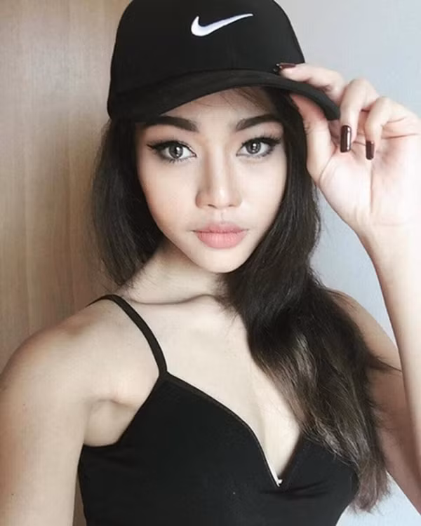 Gương mặt sau phẫu thuật thẩm mỹ của 9X cũng từng được so sánh với "hot girl môi tều" Lily Maymac.