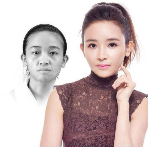 Lê Thị Thùy đến từ Hà Nội, cô bị tai nạn do bỏng nước trên vùng mặt từ bé. Sau hơn 6 tháng với nhiều lần phẫu thuật, Thùy đã có một làn da láng mịn cùng với gương mặt khá Hàn Quốc.