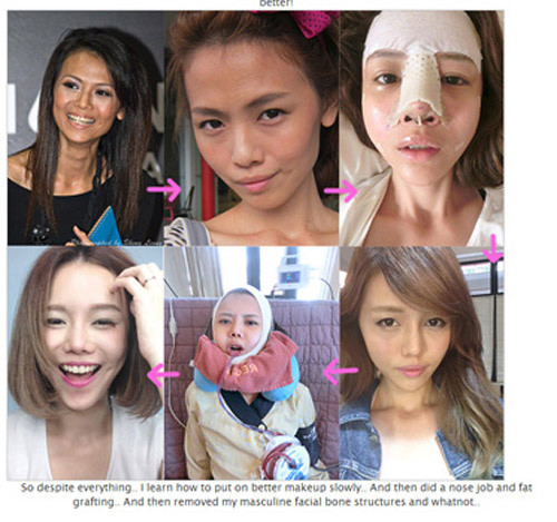 Toàn bộ quá trình thay đổi sắc đẹp của blogger nổi tiếng người Singapore là Qiu Qiu.