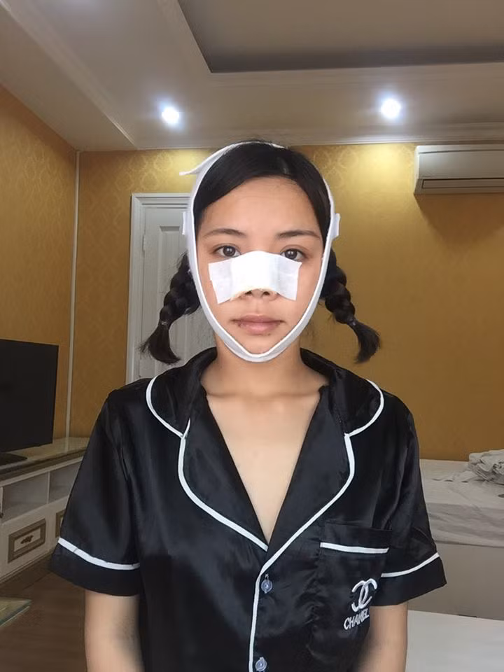 Cô gái trẻ được nhắc tới đó là Kim Phượng. Trong một group về phẫu thuật thẩm mỹ, Phượng đã mạnh dạn chia sẻ câu chuyện của mình như sau "Mình sở hữu gương mặt kém xinh và thường xuyên bị bạn bè tô răng hô, mũi heo, ăn đu đủ không cần thìa. Bị chê như vậy, mình tủi thân lắm. Sau khi ra trường làm bất động sản, với ngoại hình kém ưa nhìn, nhiều lúc thiếu tự tin với khách hàng và bị trượt khá nhiều dự án lớn.