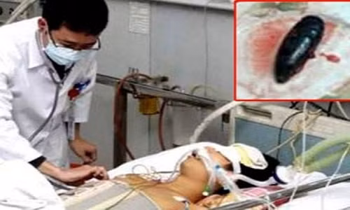 Bac si noi gi neu ban co y dinh nuot mat ca tram chua benh?