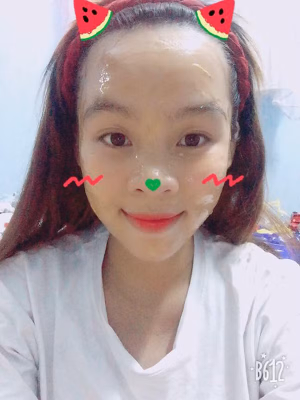 Mắt một mí, mũi tẹt hay răng nhấp nhô còn có thể đầu tư tiền bạc để "dao kéo' chứ sở hữu chiếc trán "sân bay" thế này thì các cô nàng chỉ còn biết ngậm ngùi tìm cách 'chống chế' để 'sống chung với lũ' vì đủ thứ rắc rối.