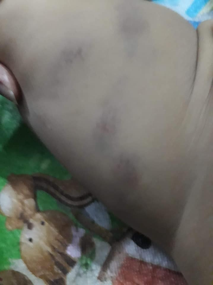 Còn nickname Thanh Hà chia sẻ: "Nhiều vết bầm tím trên mặt quá, bảo sao các con cứ nhắc đến đi lớp là lại khóc lóc thảm thiết. Đây cũng là một phần lý do, sợ các cô đánh, đánh cháu tới bầm dập cả người".