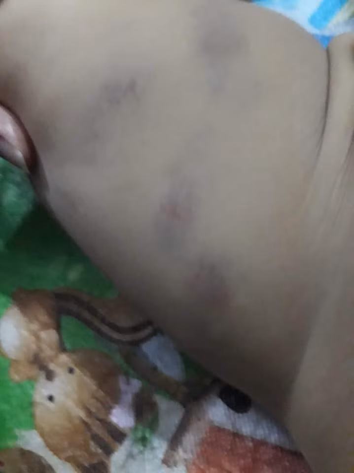 Còn nickname Thanh Hà chia sẻ: "Nhiều vết bầm tím trên mặt quá, bảo sao các con cứ nhắc đến đi lớp là lại khóc lóc thảm thiết. Đây cũng là một phần lý do, sợ các cô đánh, đánh cháu tới bầm dập cả người".