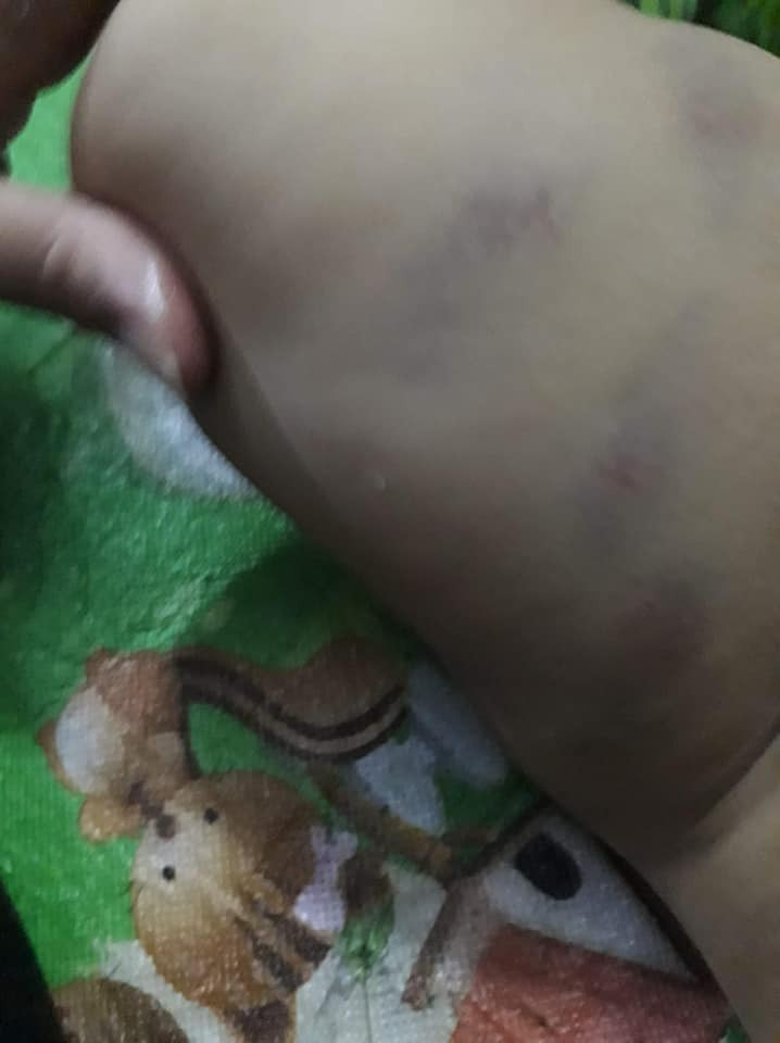 "Đẻ con ra mà không xót, cùng là giáo viên thật chứ đây mà là con mình thì họ hàng nhận không ra 2 đứa giáo viên kia luôn. Cái trường kia đóng cửa luôn. Đọc tức giáo viên 1 thì tức con mẹ ngu 10. Chỉ tội cho em bé", nickname Thanh Thúy chia sẻ thêm.