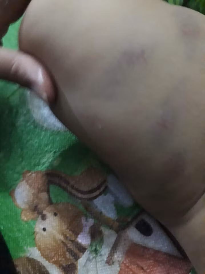 "Đẻ con ra mà không xót, cùng là giáo viên thật chứ đây mà là con mình thì họ hàng nhận không ra 2 đứa giáo viên kia luôn. Cái trường kia đóng cửa luôn. Đọc tức giáo viên 1 thì tức con mẹ ngu 10. Chỉ tội cho em bé", nickname Thanh Thúy chia sẻ thêm.