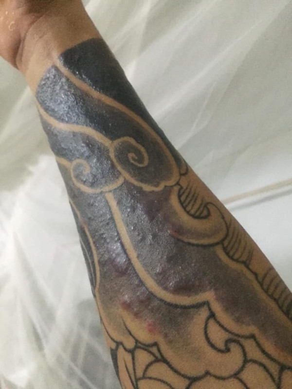 Nguyên nhân ban đầu theo tiết lộ của chủ tiệm xăm là do mực kém chất lượng và yêu cầu shop bán mực xăm phải có trách nhiệm.