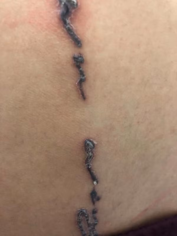 Sau đó Linh có liên hệ với shop bán mực xăm có tên Tatushop đều khẳng định sẽ có trách nhiệm và đền bù cho những khách hàng trên nhưng đến thời điểm này sau hơn 2 tháng, shop bán mực xăm trên vẫn chưa có động tĩnh thực hiện điều mình nói.