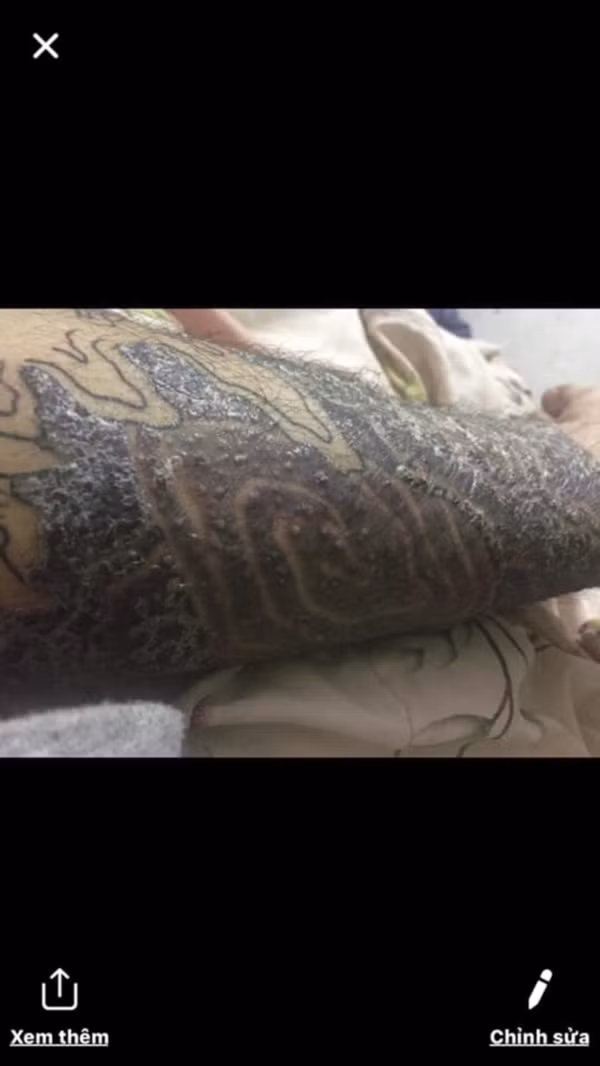 Như đã biết, việc xăm hình với loại mực chất lượng kém mang đến nhiều hiểm họa. Đầu tiên phải nhắc tới đó là chất lượng hình xăm kém bền màu, nguyên hiểm hơn đó là các kích ứng trên da dẫn đến việc nhiễm trùng.