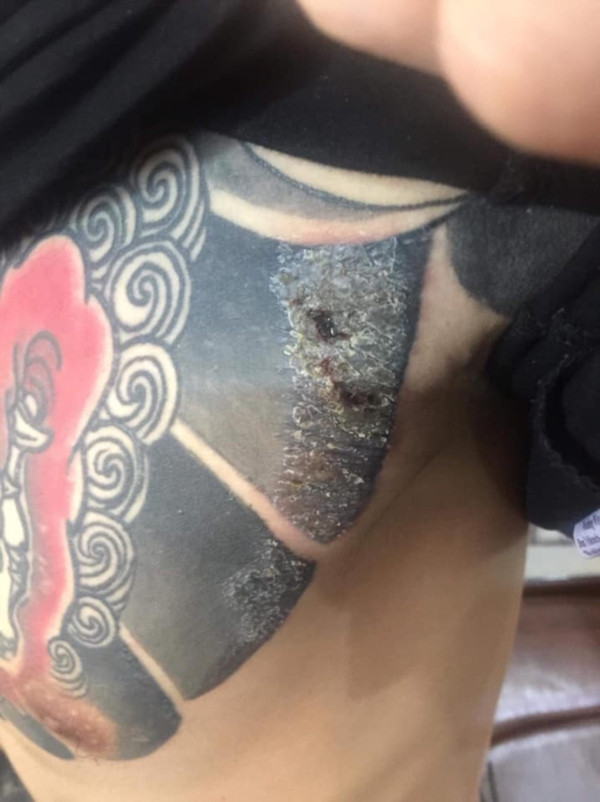 Trên trang cá nhân của mình, nickname Nguyễn Văn Linh đăng tải bài viết tố cáo shop bán mực xăm kém chất lượng khiến khách hàng của mình gặp vấn đề về da liễu.