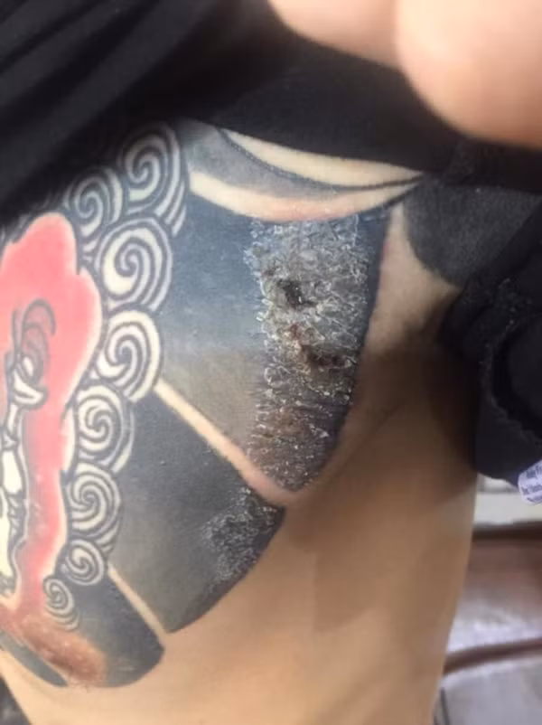 Trên trang cá nhân của mình, nickname Nguyễn Văn Linh đăng tải bài viết tố cáo shop bán mực xăm kém chất lượng khiến khách hàng của mình gặp vấn đề về da liễu.