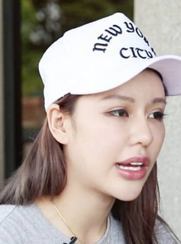 Tuy nhiên không may cho Berry Ng vì thời gian làm quá gấp rút nên phần mũi của cô gái 9X Hong Kong này rơi vào tình trạng nóng bừng và chảy mủ. Trong thời gian đó, Berry Ng đang thực hiện quá trình nâng ngực nhưng gia đình phản đối vô cùng kịch liệt.