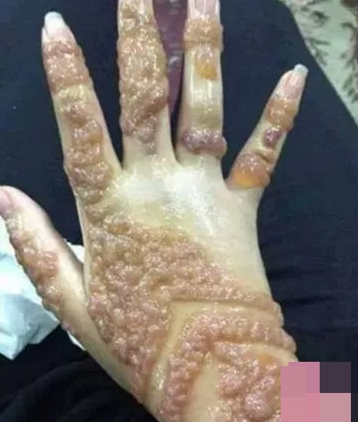 Ngoài ra, mực xăm henna còn chứa cả các hóa chất khác có thể gây ung thư như thuốc nhuộm và xăng.